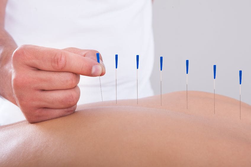 Managing Disc Protrusion With Acupuncture