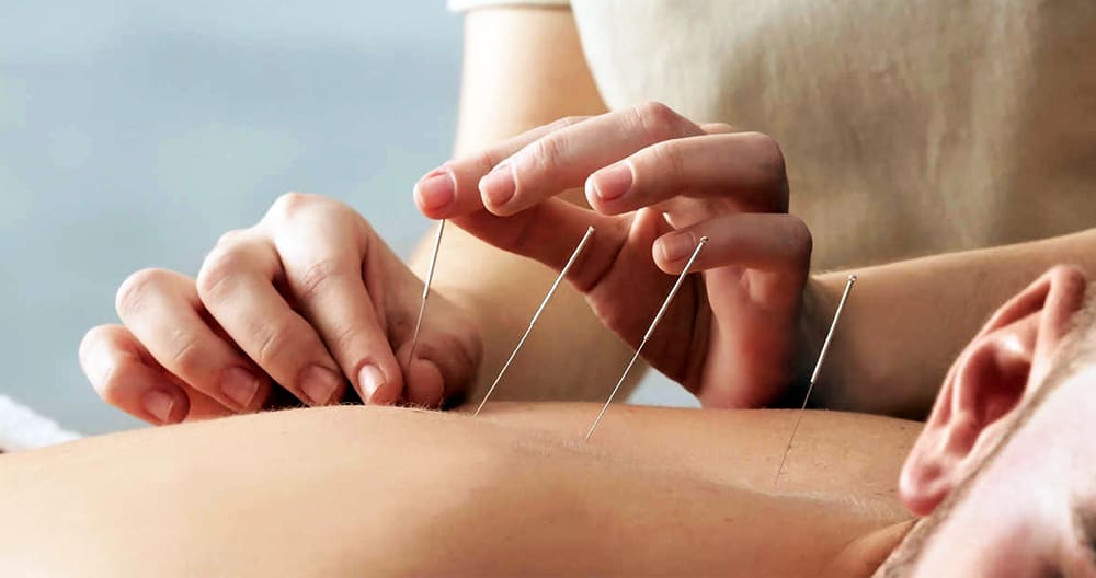 Managing Disc Protrusion With Acupuncture