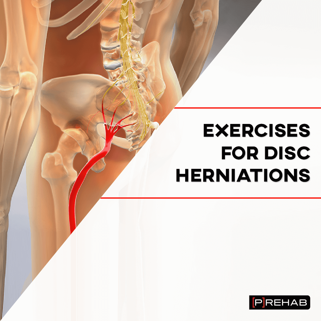 Preventing Disc Protrusion: Tips For Recreational Activities Preventing Disc Protrusion: Tips For Recreational Activities