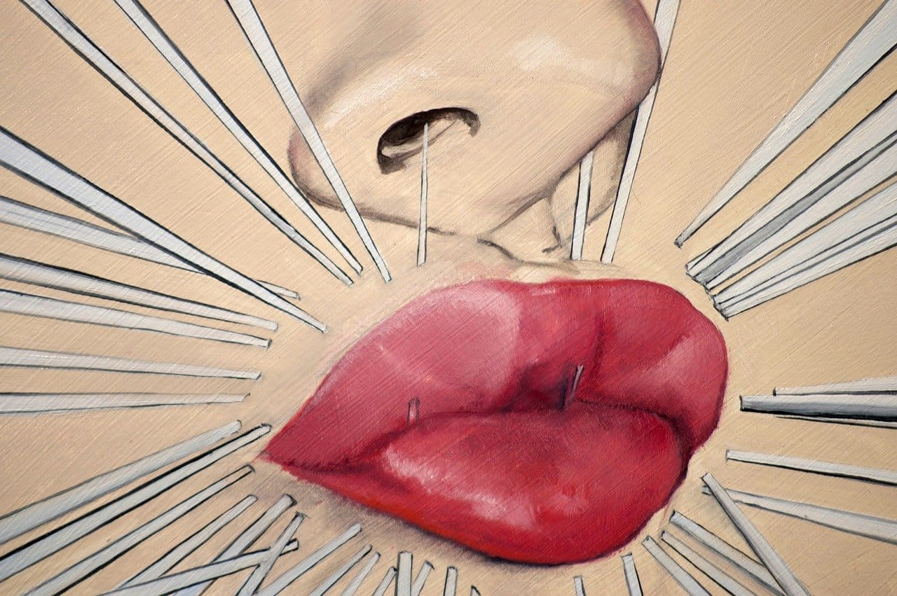 Does Acupuncture Help With Disc Protrusion Pain?