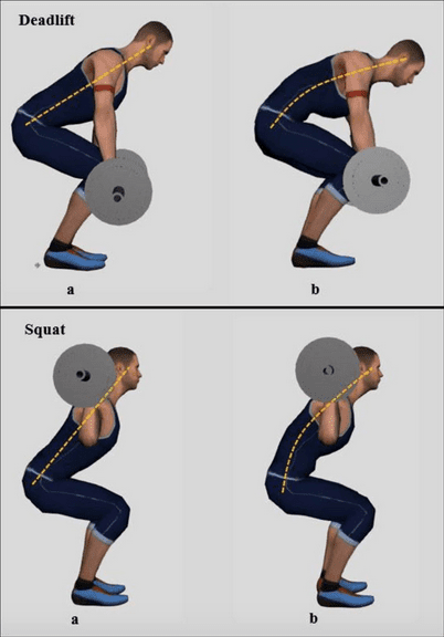 How Does Poor Lifting Posture Contribute To Disc Protrusion?