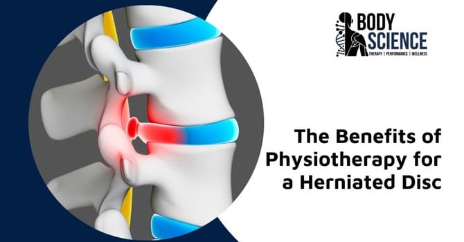 Understanding The Benefits Of Physical Therapy For Disc Protrusion