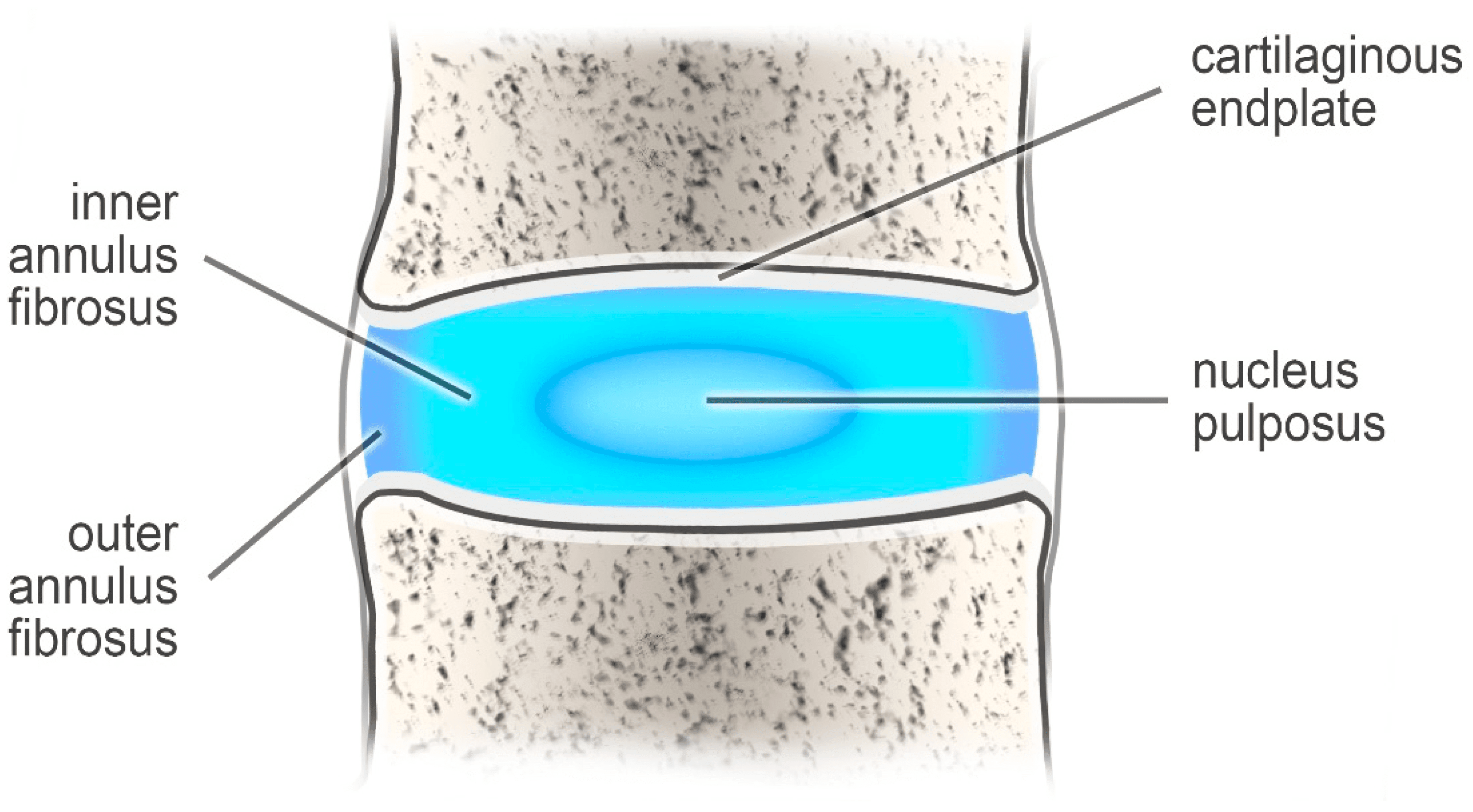 Do Certain Ergonomic Factors Increase The Risk Of Disc Protrusion? Do Certain Ergonomic Factors Increase The Risk Of Disc Protrusion?