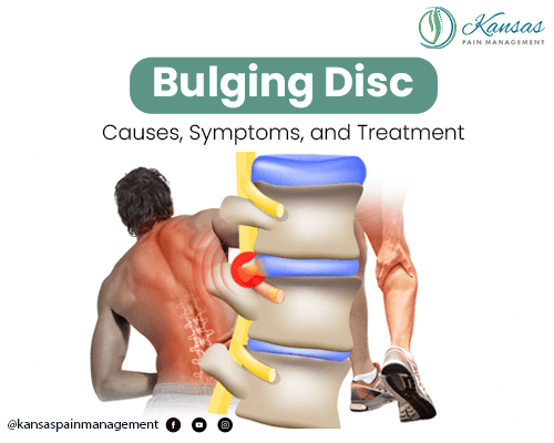 Do Certain Ergonomic Factors Increase The Risk Of Disc Protrusion? Do Certain Ergonomic Factors Increase The Risk Of Disc Protrusion?