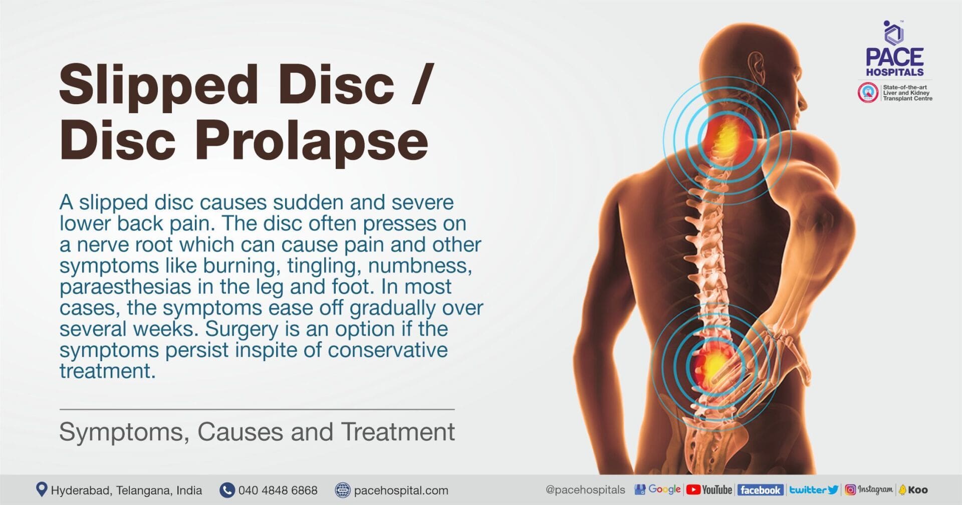 Recovery And Management Support For Disc Protrusion Patients