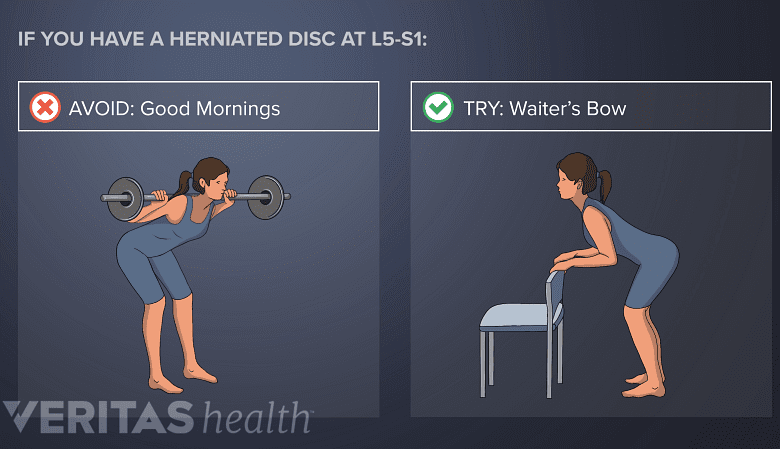 Top Ways To Prevent Disc Protrusion During Exercise