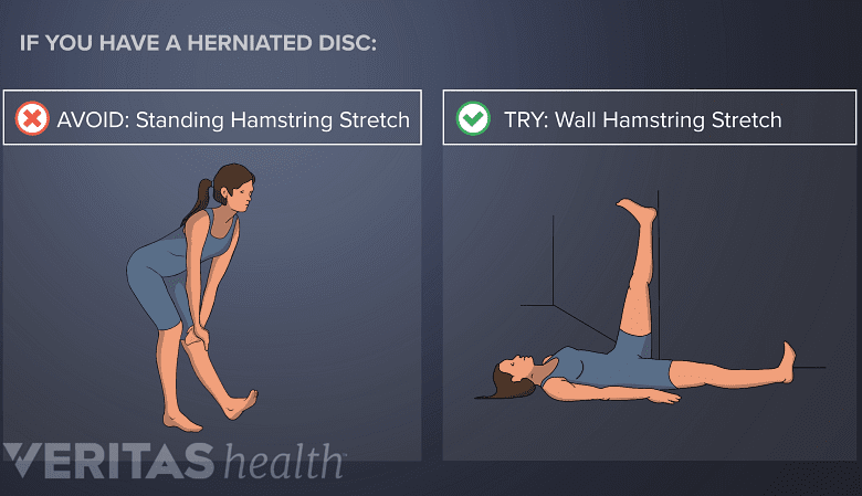 How To Stretch And Strengthen For Disc Protrusion Prevention