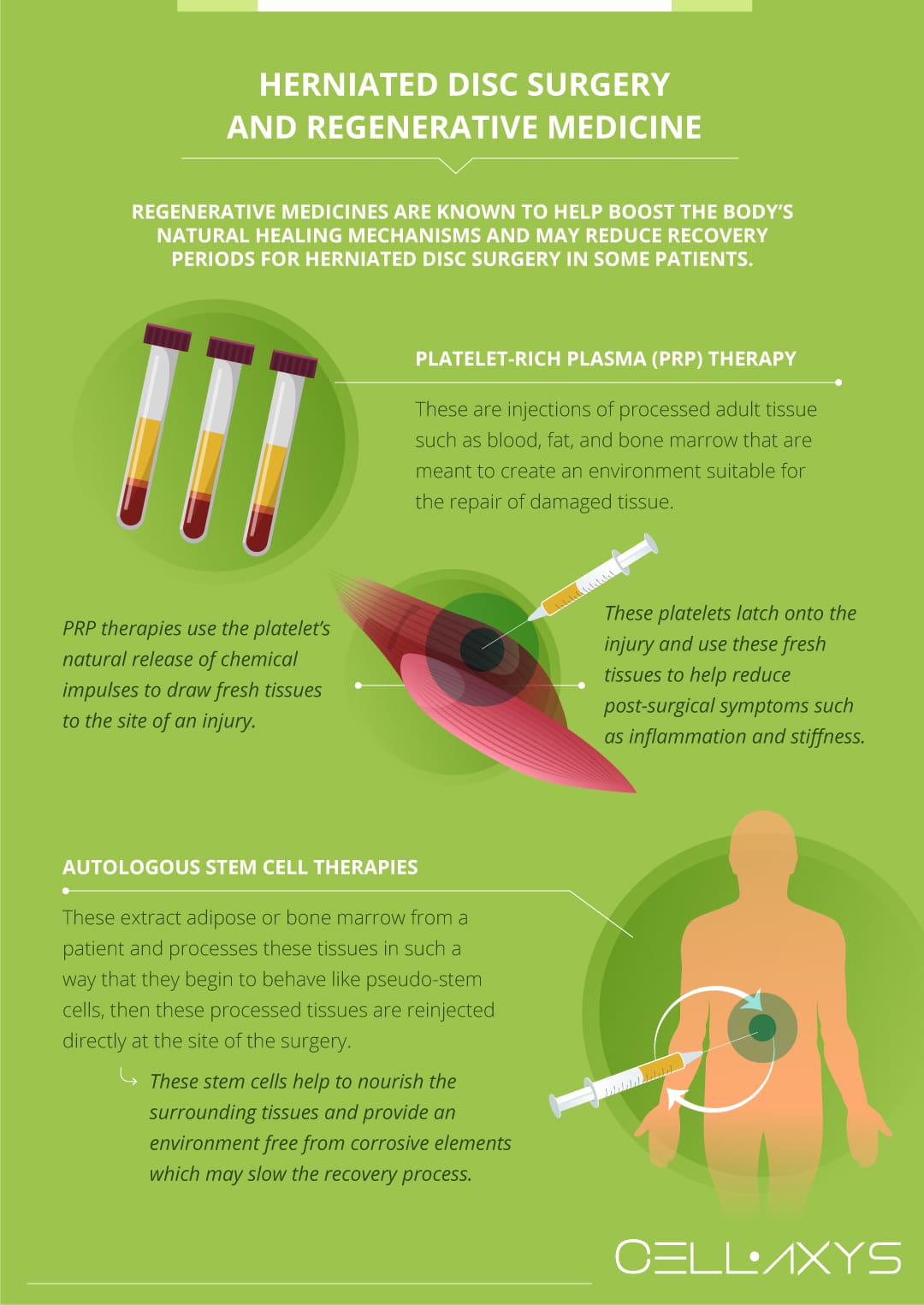 Key Principles For Successful Recovery From Disc Protrusion