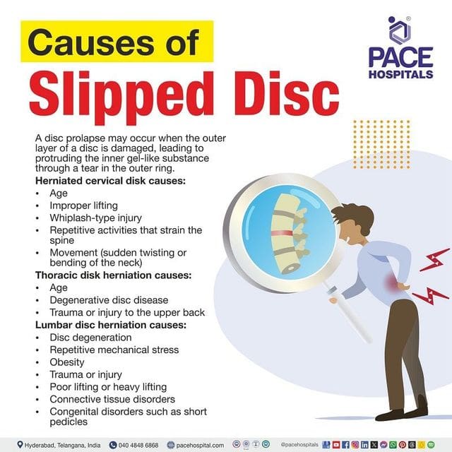 Most Important Facts To Know About Disc Protrusion Prevention