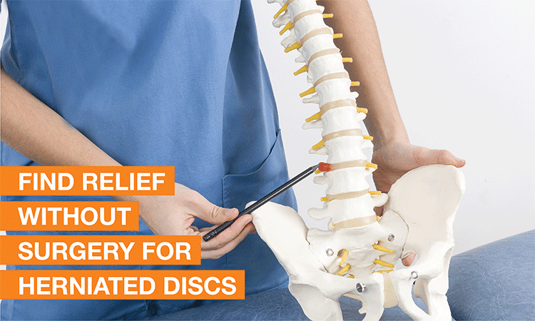 Non-surgical Approaches To Managing Disc Protrusion
