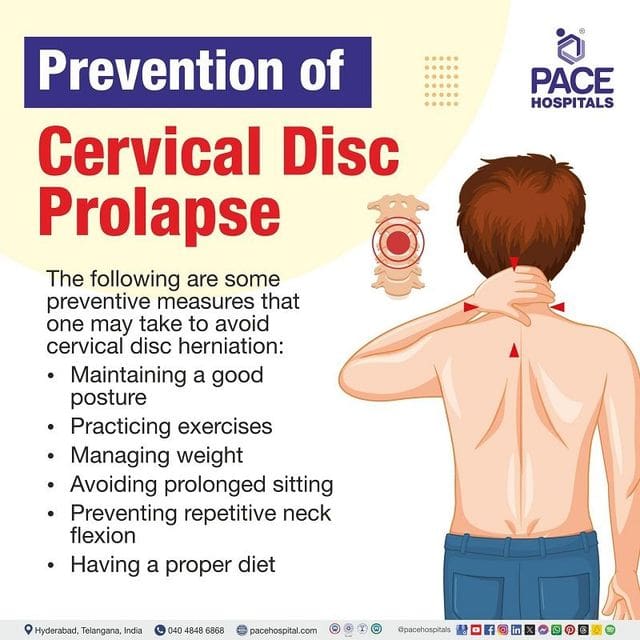 Best Practices For Preventing Disc Protrusion
