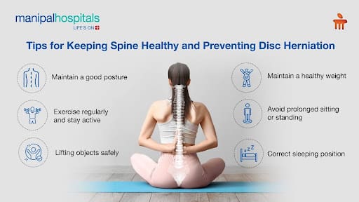 Best Practices For Preventing Disc Protrusion
