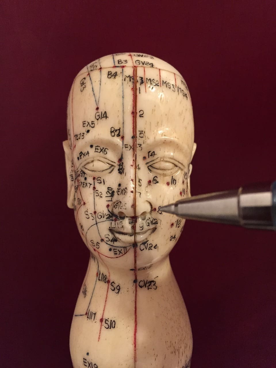 The Benefits Of Acupuncture And Traditional Chinese Medicine For Disc Protrusion
